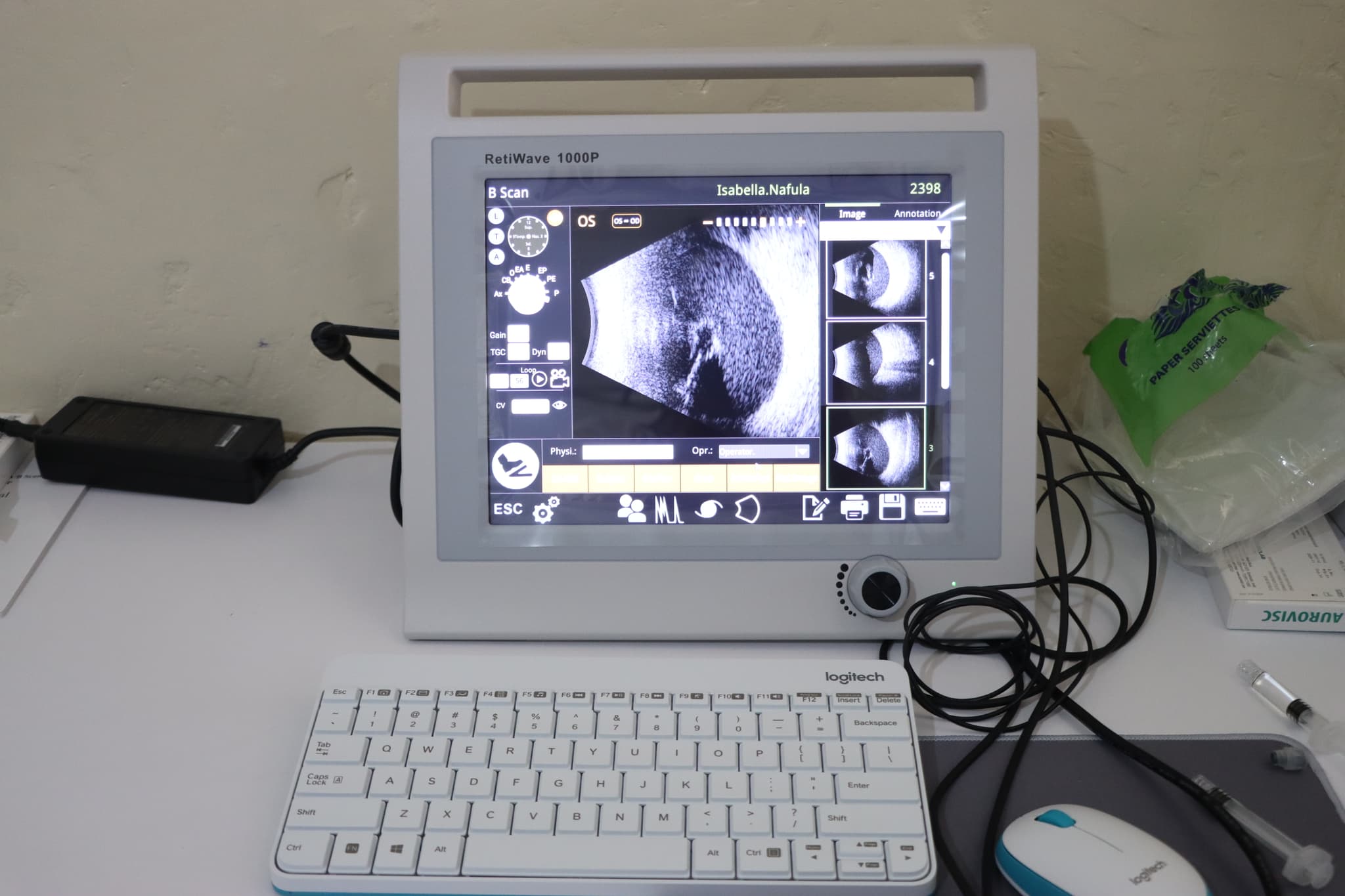 Glaucoma Management